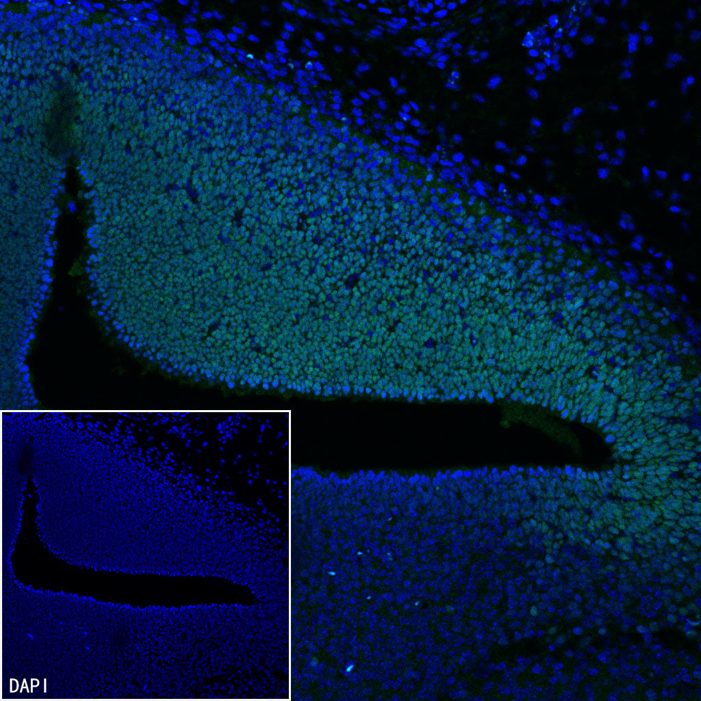 Lhx2/LH2 Recombinant Rabbit mAb (S-3867-28)