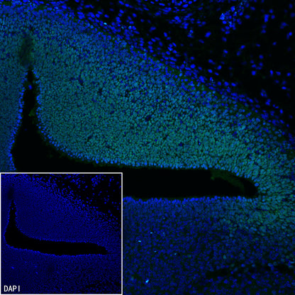Lhx2/LH2 Recombinant Rabbit mAb (S-3867-28)