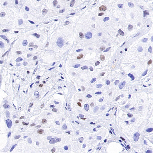 p27 Recombinant Rabbit mAb (SDT-R350)