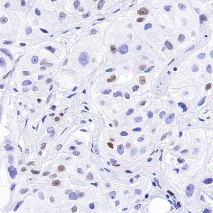 p27 Recombinant Rabbit mAb (SDT-R350)
