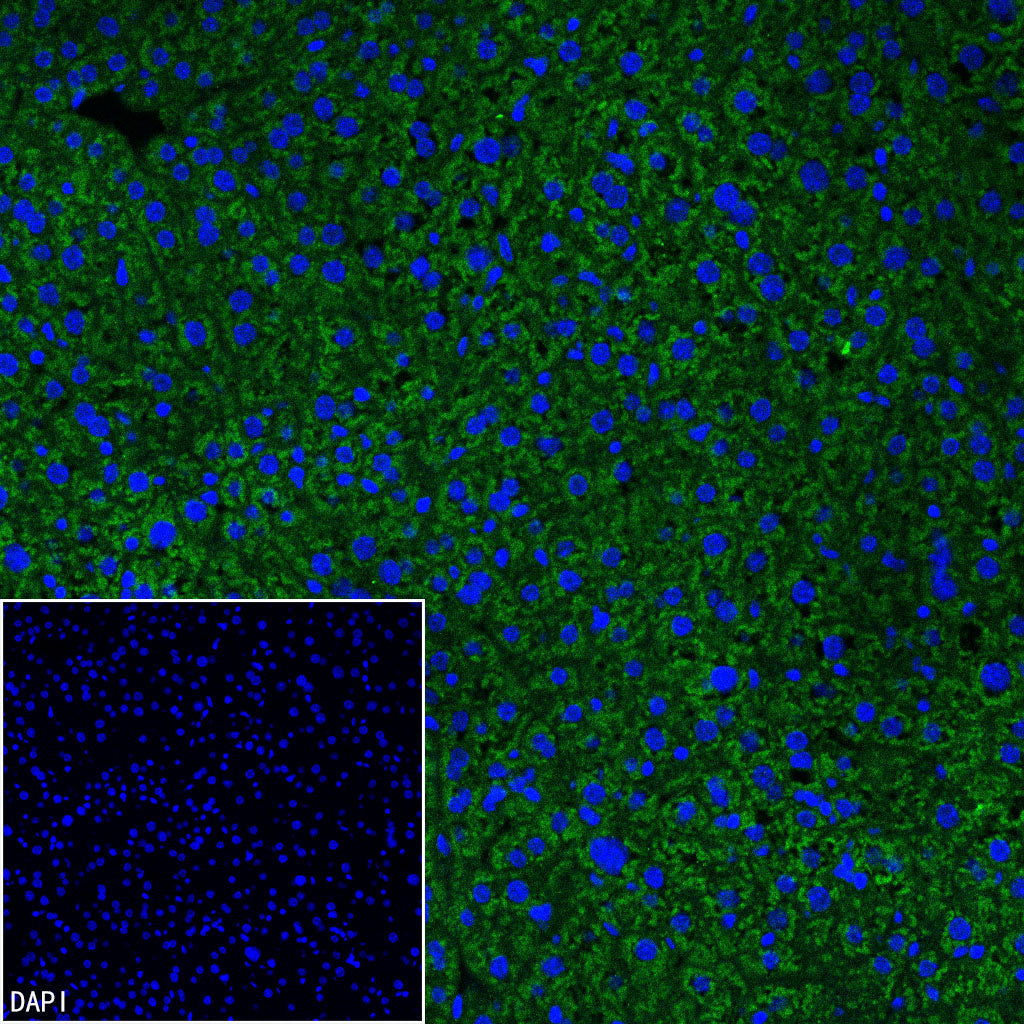 RPS14 Rabbit Polyclonal Antibody