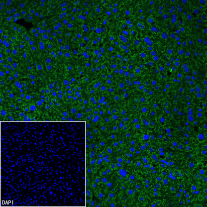 RPS14 Rabbit Polyclonal Antibody