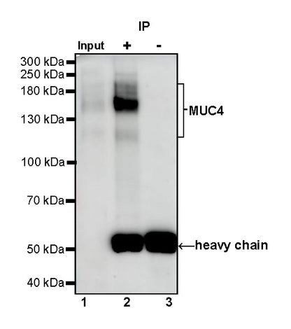MUC4 Recombinant Rabbit mAb (SDT-841-13)