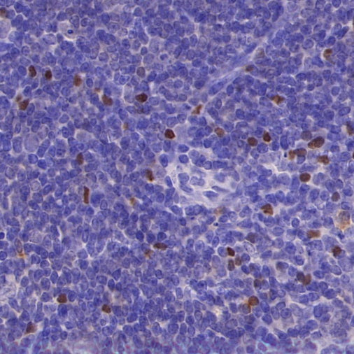 FOXP3 Recombinant Mouse mAb (SDT-3494)