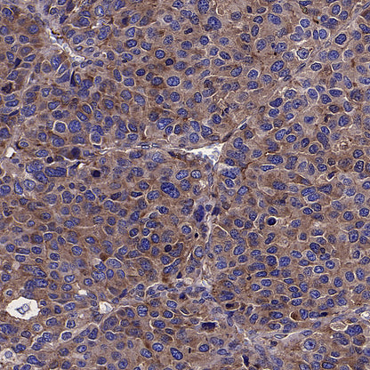 Choline Kinase α/CHKA Recombinant Rabbit mAb (S-4422-31)