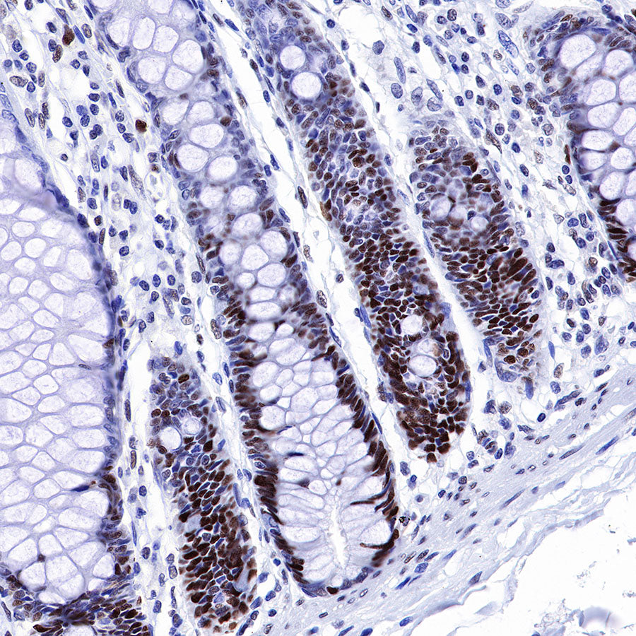 S-RMab® MSH6 Recombinant Rabbit mAb,PBS Only (SDT-R094)