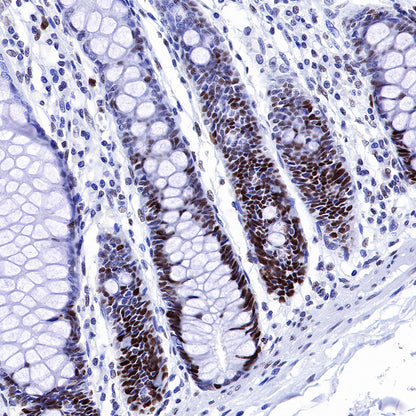 S-RMab® MSH6 Recombinant Rabbit mAb,PBS Only (SDT-R094)