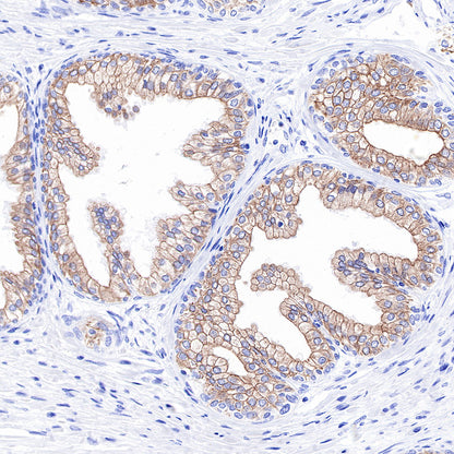 Keratin 18 Recombinant Rabbit mAb (SDT-R081)