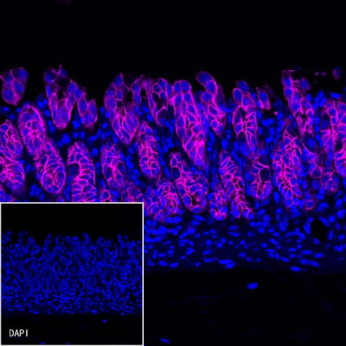 E-Cadherin Recombinant Rabbit mAb (Cy5 Conjugate) (S-438-5)