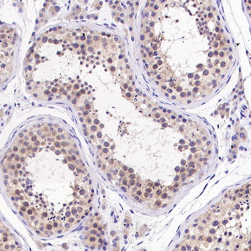 UBE2F Recombinant Rabbit mAb (S-2672-26)