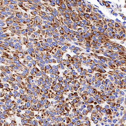 Cytokeratin 7 Recombinant Rabbit mAb (S-5954)