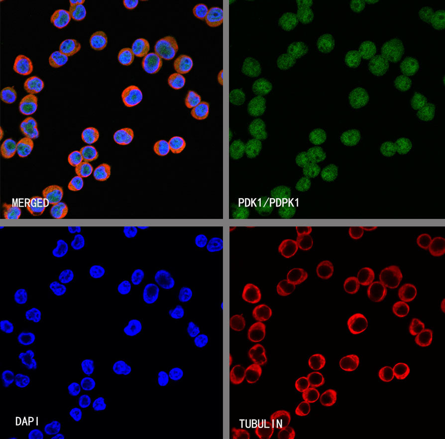 PDK1/PDPK1 Recombinant Rabbit mAb (S-3050-116)