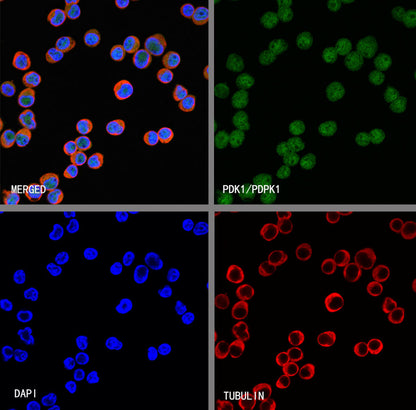 PDK1/PDPK1 Recombinant Rabbit mAb (S-3050-116)