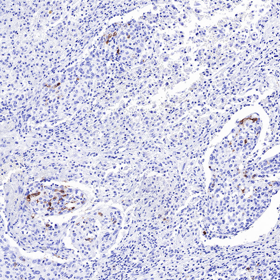 CD1A Recombinant Rabbit mAb (SDT-R086)