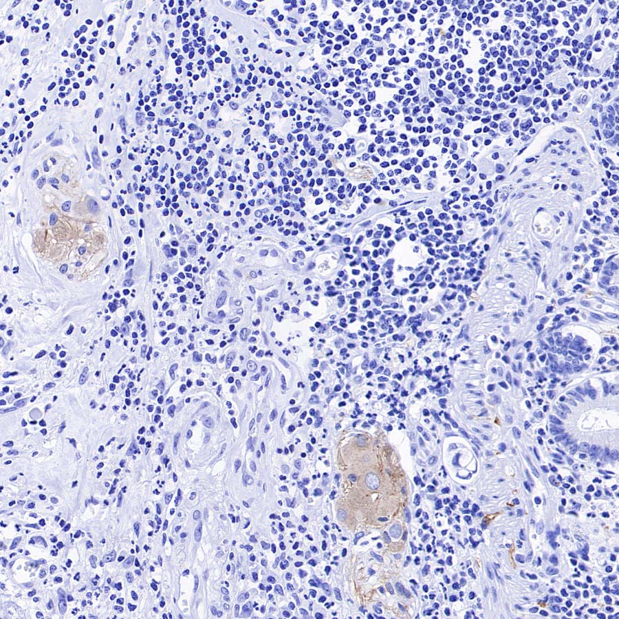 pan SCN Recombinant Rabbit mAb (S-5038)