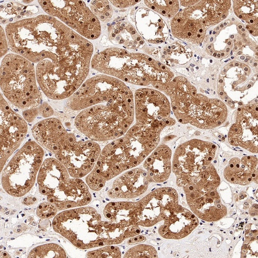 PSMB5 Rabbit Polyclonal Antibody