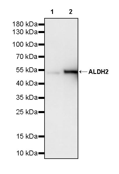 ALDH2 Mouse mAb