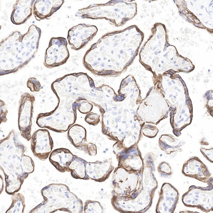 Cytokeratin 7 Recombinant Rabbit mAb (SDT-R028)
