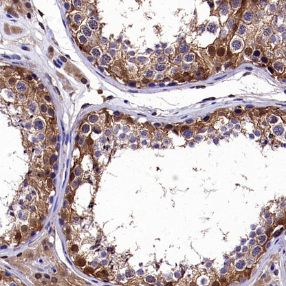 AKT2 Recombinant Rabbit mAb (S-2617-6)