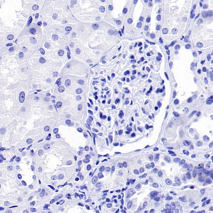 Invivo mouse IgG1 isotype control (D265A)
