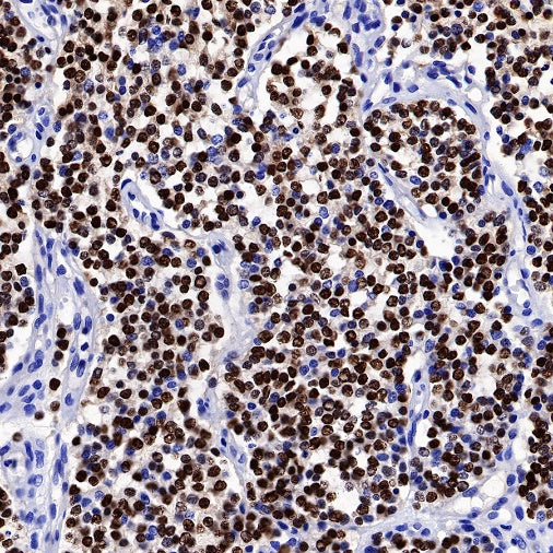Olig2 Recombinant Rabbit mAb (SDT-648-155)