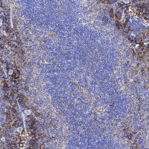 VCAM1 Recombinant Rabbit mAb (S-650-19)