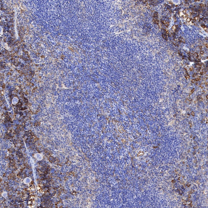 VCAM1 Recombinant Rabbit mAb (S-650-19)