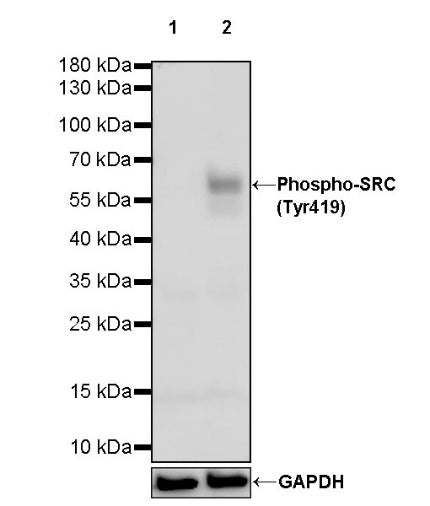 Phospho-SRC (Tyr419) Recombinant Rabbit mAb (S-1182-5)