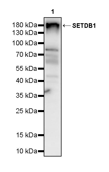 SETDB1 Recombinant Rabbit mAb (S-4094-31)