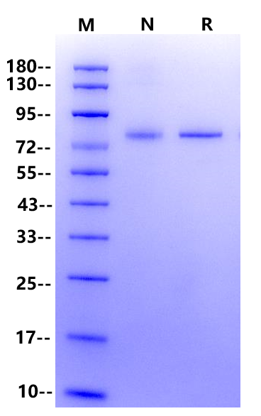 M-MLV (H-) Reverse Transcriptase
