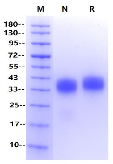 Fc γ RIIIb/CD16b(NA1) His Tag Protein, Human