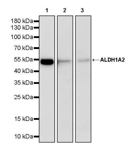 ALDH1A2 Recombinant Rabbit mAb (S-3569-78)