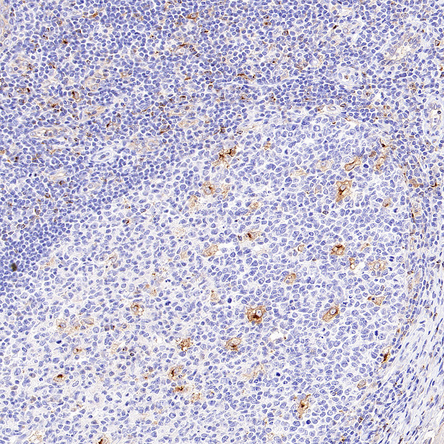 CCL18 Recombinant Rabbit mAb (S-2788-25)