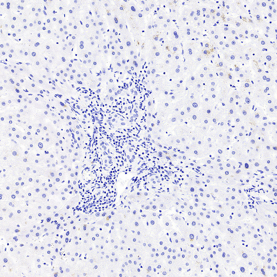 Myoglobin Recombinant Rabbit mAb (S-6197)
