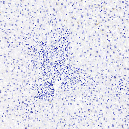 Myoglobin Recombinant Rabbit mAb (S-6197)
