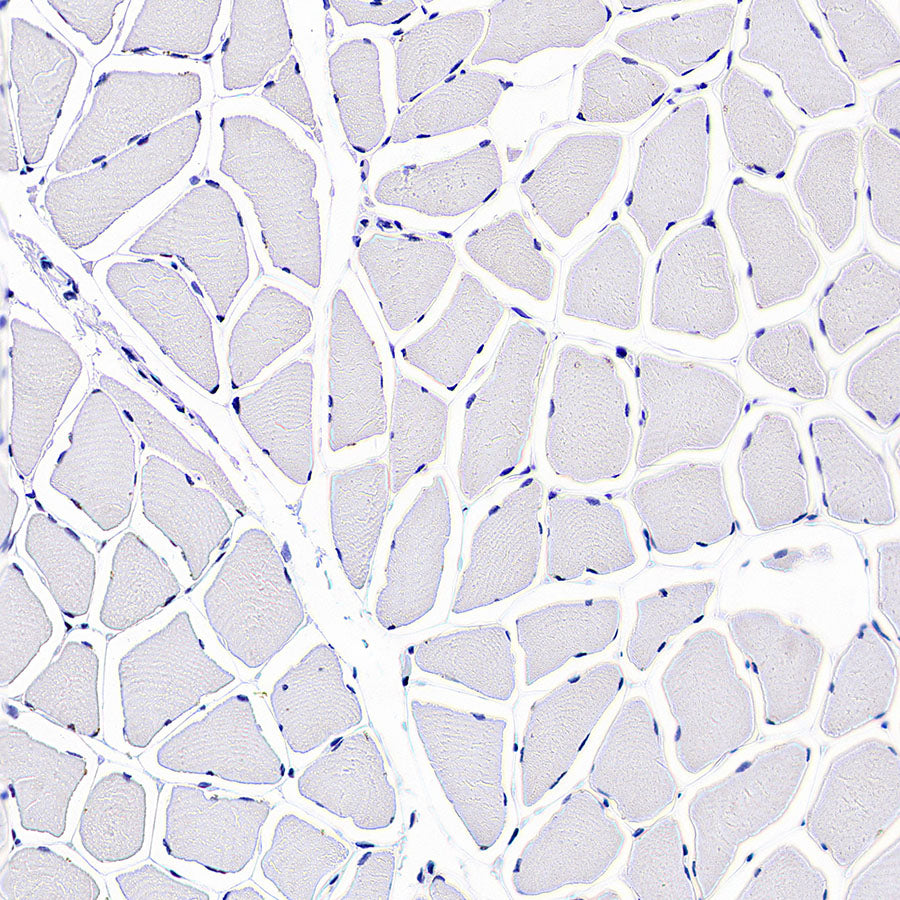 ATAD2 Recombinant Rabbit mAb (S-4145-63)