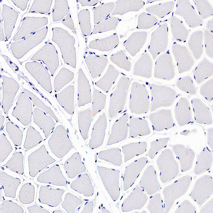 ATAD2 Recombinant Rabbit mAb (S-4145-63)