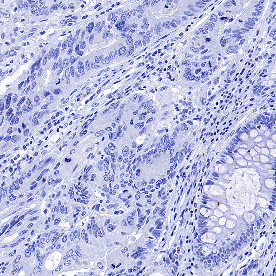 Phospho-HSP27 (Ser82) Recombinant Rabbit mAb (S-4792)