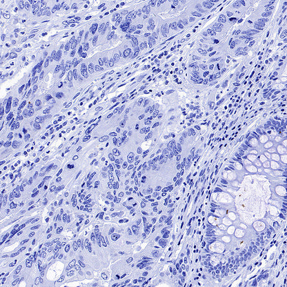 Phospho-HSP27 (Ser82) Recombinant Rabbit mAb (S-4792)