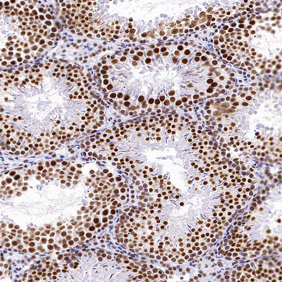 CDK11/CDC2L2/CDK11A Recombinant Rabbit mAb (S-3994-75)