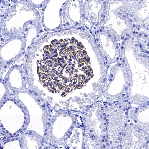 Nephrin Recombinant Rabbit mAb (S-543-63)