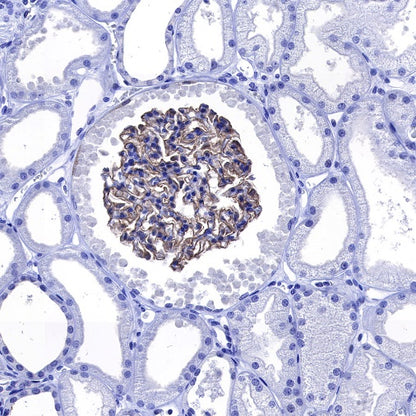 Nephrin Recombinant Rabbit mAb (S-543-63)