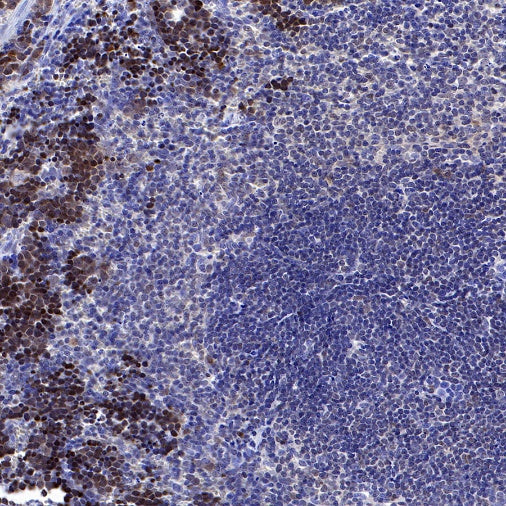 FoxO3a Recombinant Rabbit mAb (S-465-41)