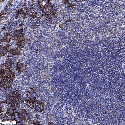 FoxO3a Recombinant Rabbit mAb (S-465-41)