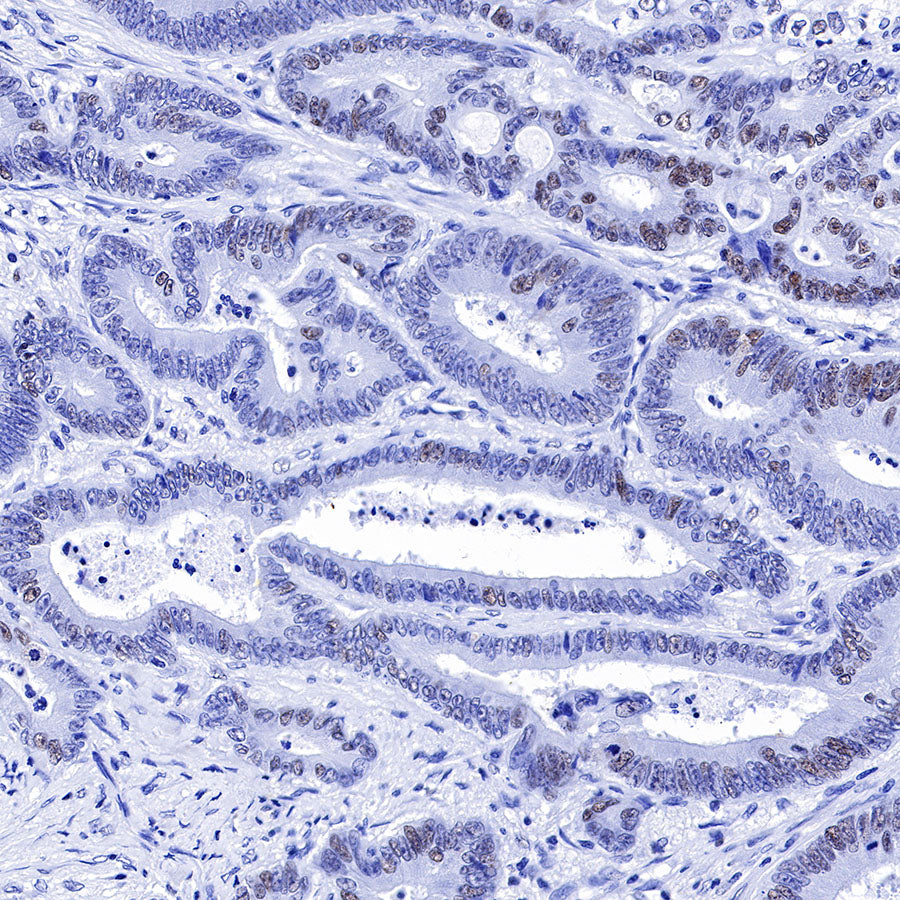 S-RMab® MSH6 Recombinant Rabbit mAb,PBS Only (SDT-R094)