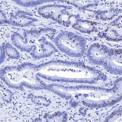 S-RMab® MSH6 Recombinant Rabbit mAb,PBS Only (SDT-R094)