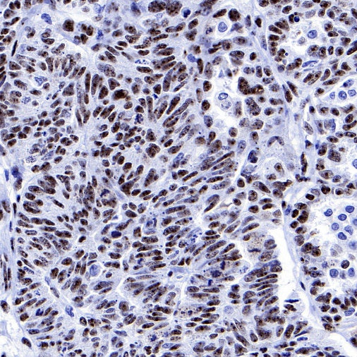 PELP1 Recombinant Rabbit mAb (S-756-22)