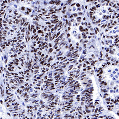 PELP1 Recombinant Rabbit mAb (S-756-22)