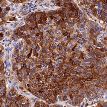 GPNMB Recombinant Rabbit mAb (S-R241)
