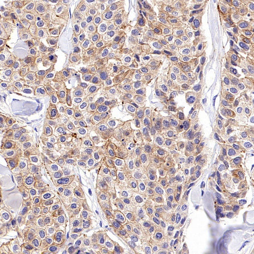 ZO-1 Recombinant Rabbit mAb (S-2188-12)